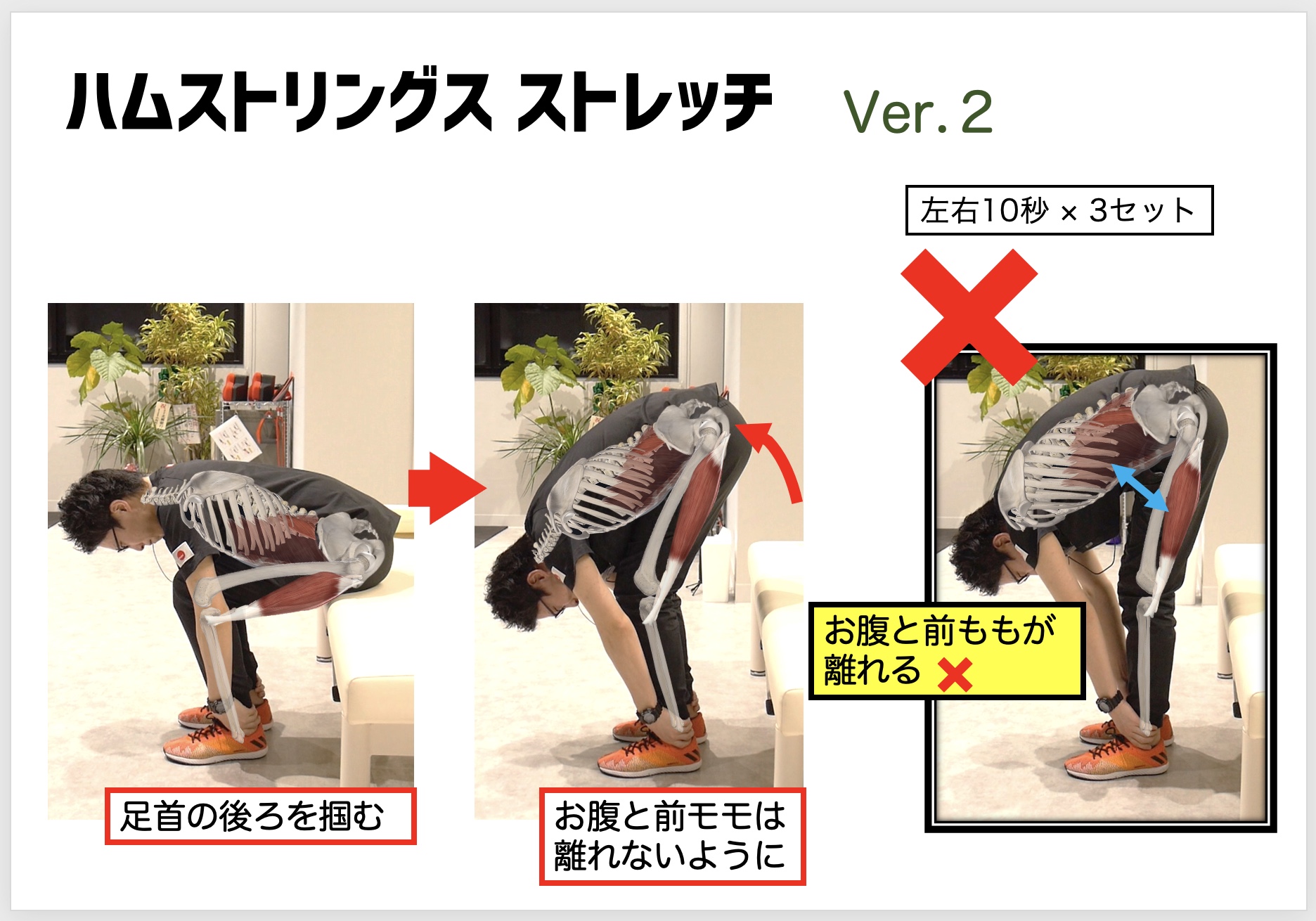 オスグッド 病 ストレッチ
